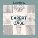 ExpertCase (kostenlos)