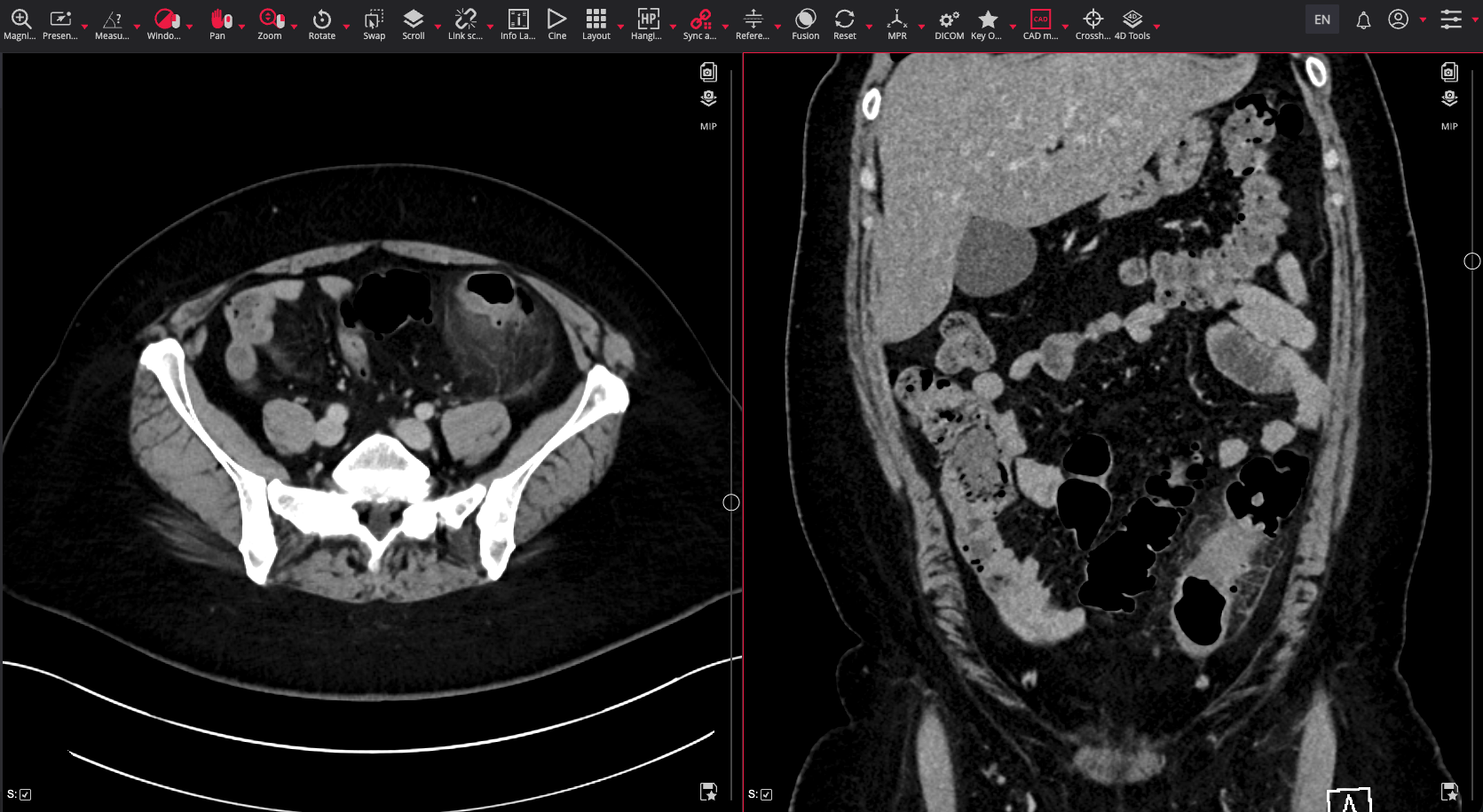 Echter Nachtdienst-Fall im DICOM-Viewer