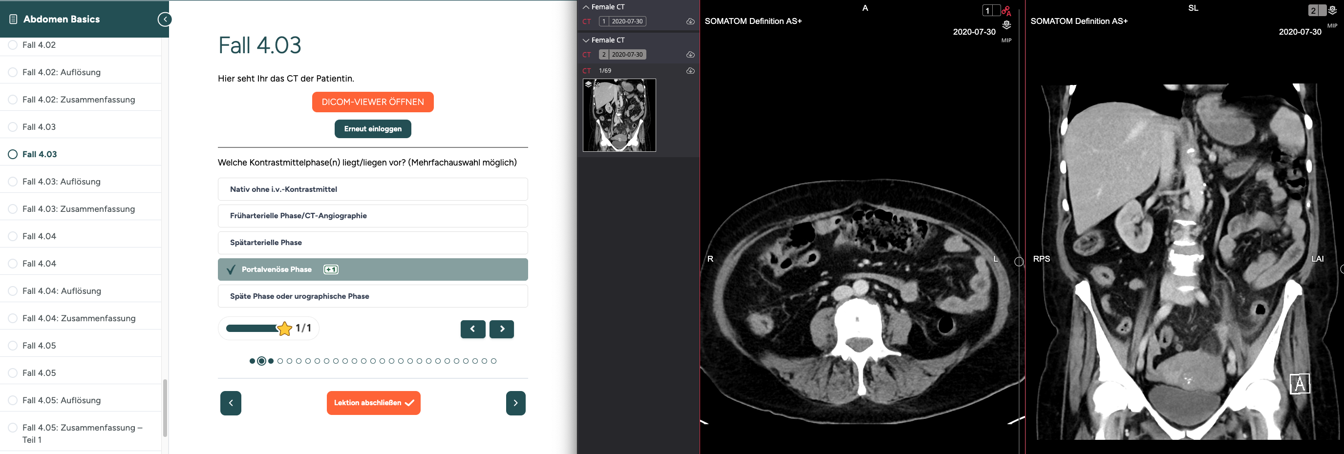 Abdomen Basics: CT-Abdomen-Fall im DICOM-Viewer