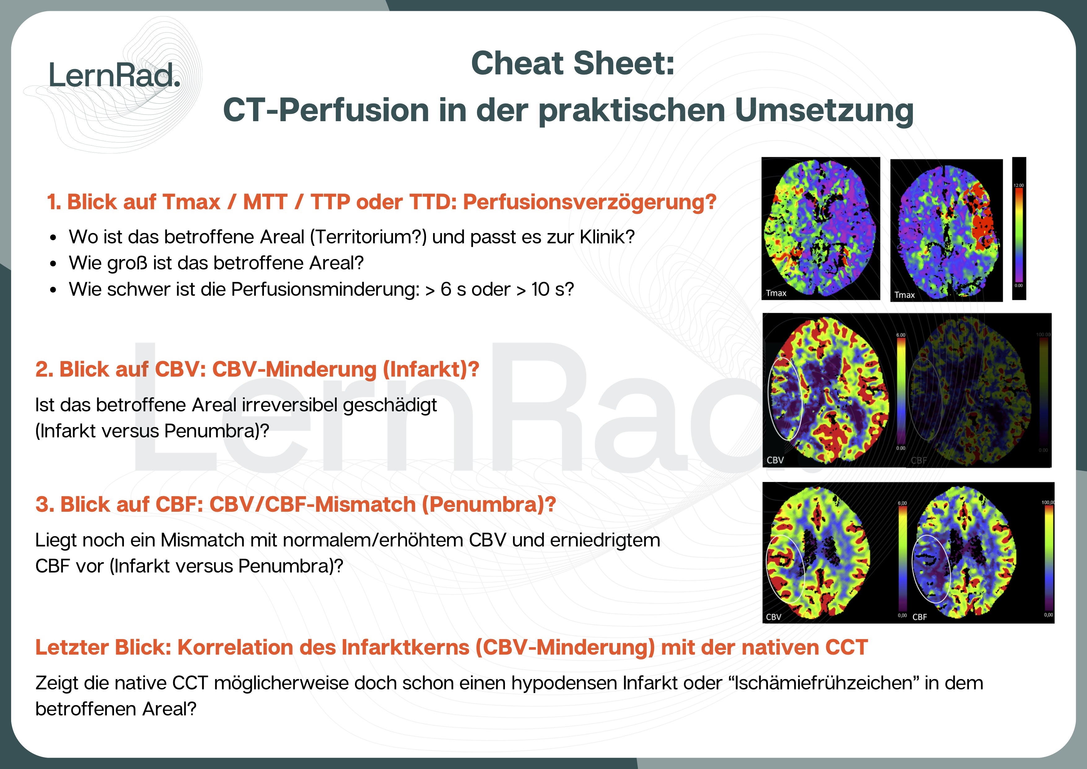 Cheat Sheet: CT-Perfusion in der praktischen Umsetzung